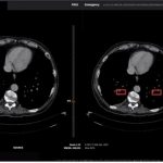 عرضه رایگان سامانه ایرانی هوشمند تشخیص کرونا به جهان