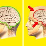 کوچک شدن مغز بر اثر بیماری روانی