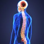 درمان آسیب نخاعی بایک برچسب